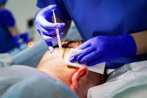 The Rise of Robotic Hair Transplants: A New Era